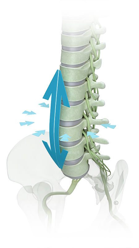 Spinal Decom